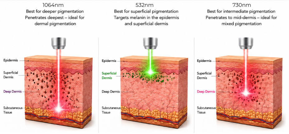 PicoWay Laser Wavelength for Different Skin Concerns in Johor Bahru